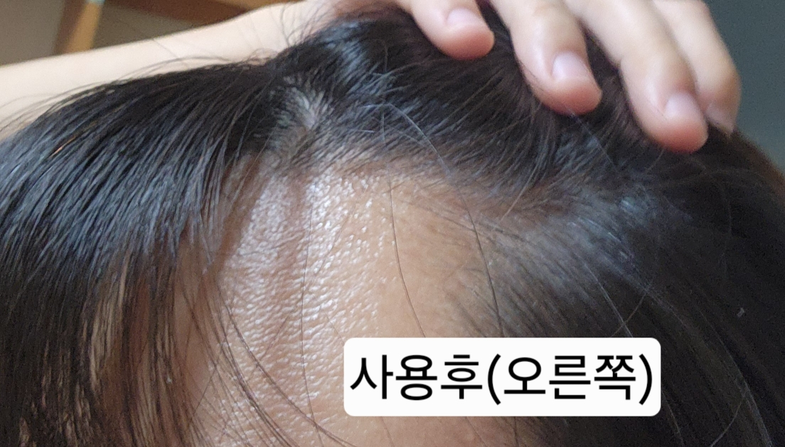 아워덤 (OURDERM) 노모어 헤어로스 부스트 앰플 review image