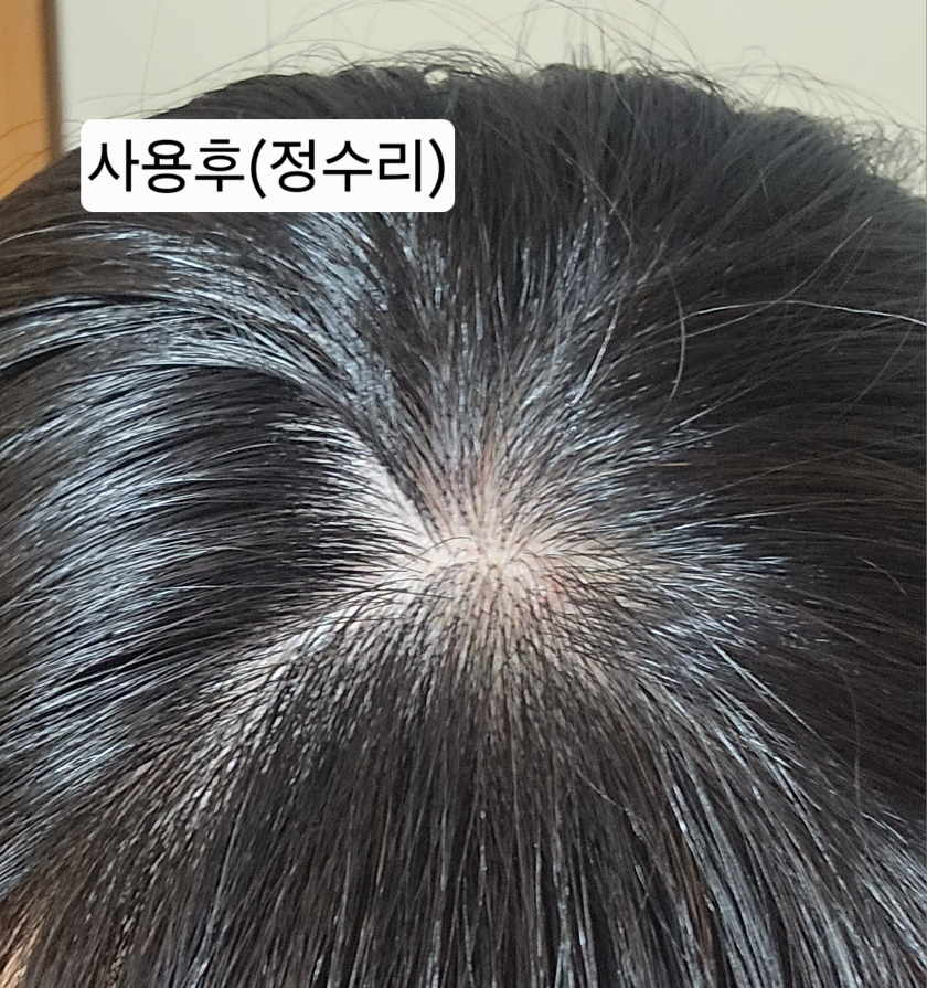 아워덤 (OURDERM) 노모어 헤어로스 부스트 앰플 review image