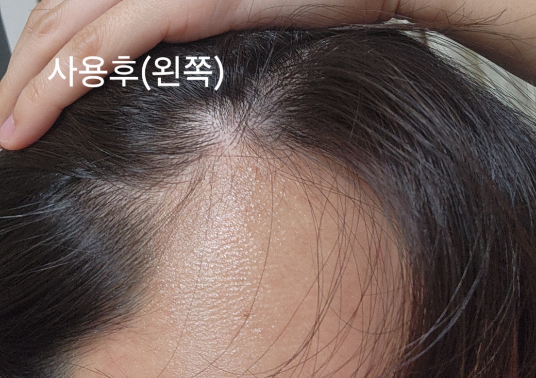 아워덤 (OURDERM) 노모어 헤어로스 부스트 앰플 review image