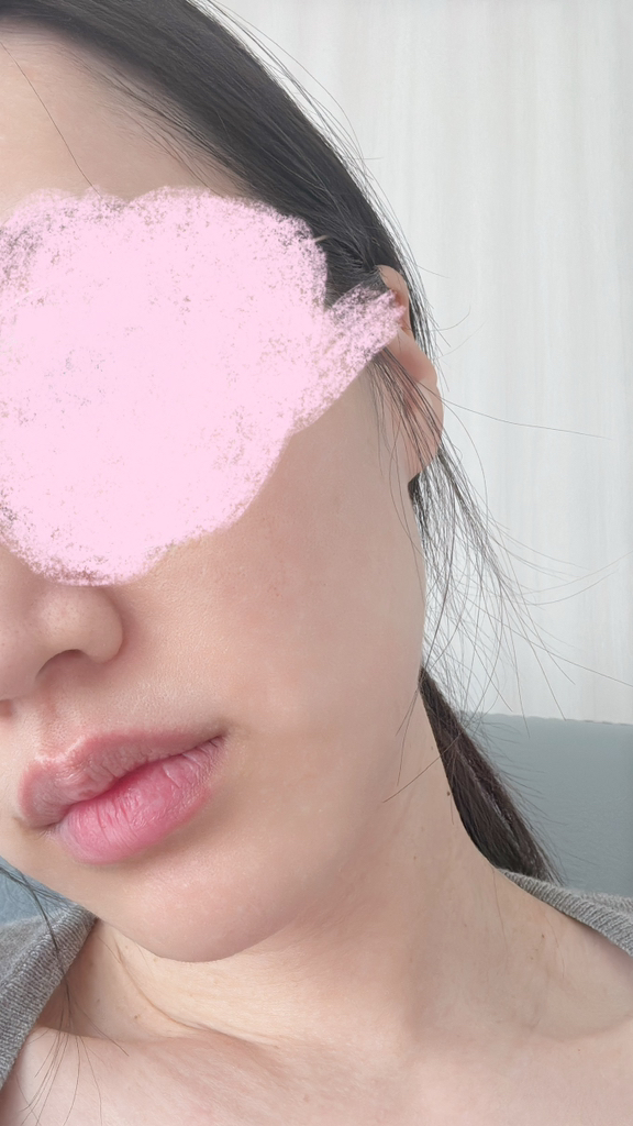 엘리샤코이 (Elishacoy) 콤부차 결바이옴 미스트 review image