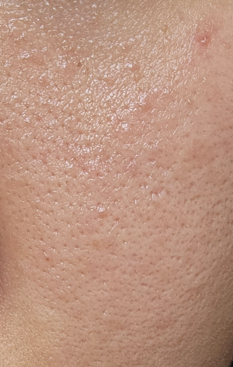 BEAUTIO EGF+hGH Revital Ampoule review image