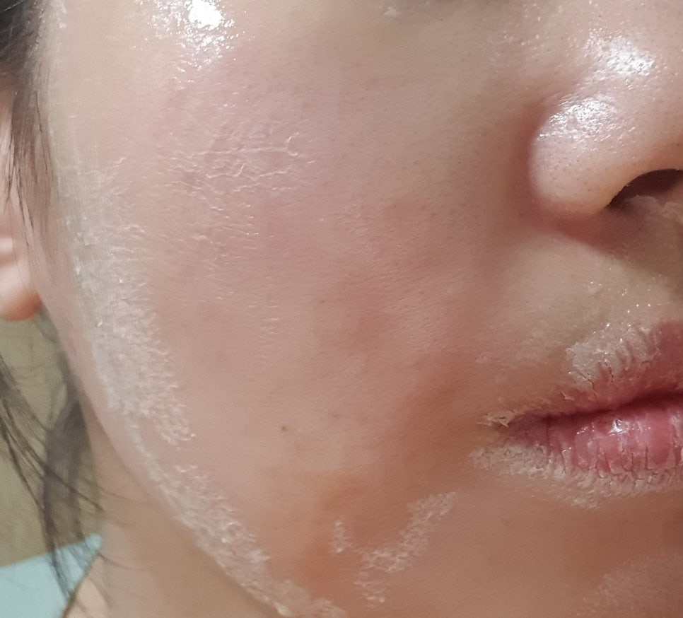 좀비뷰티 (ZOMBIEBEAUTY) 좀비팩 review image