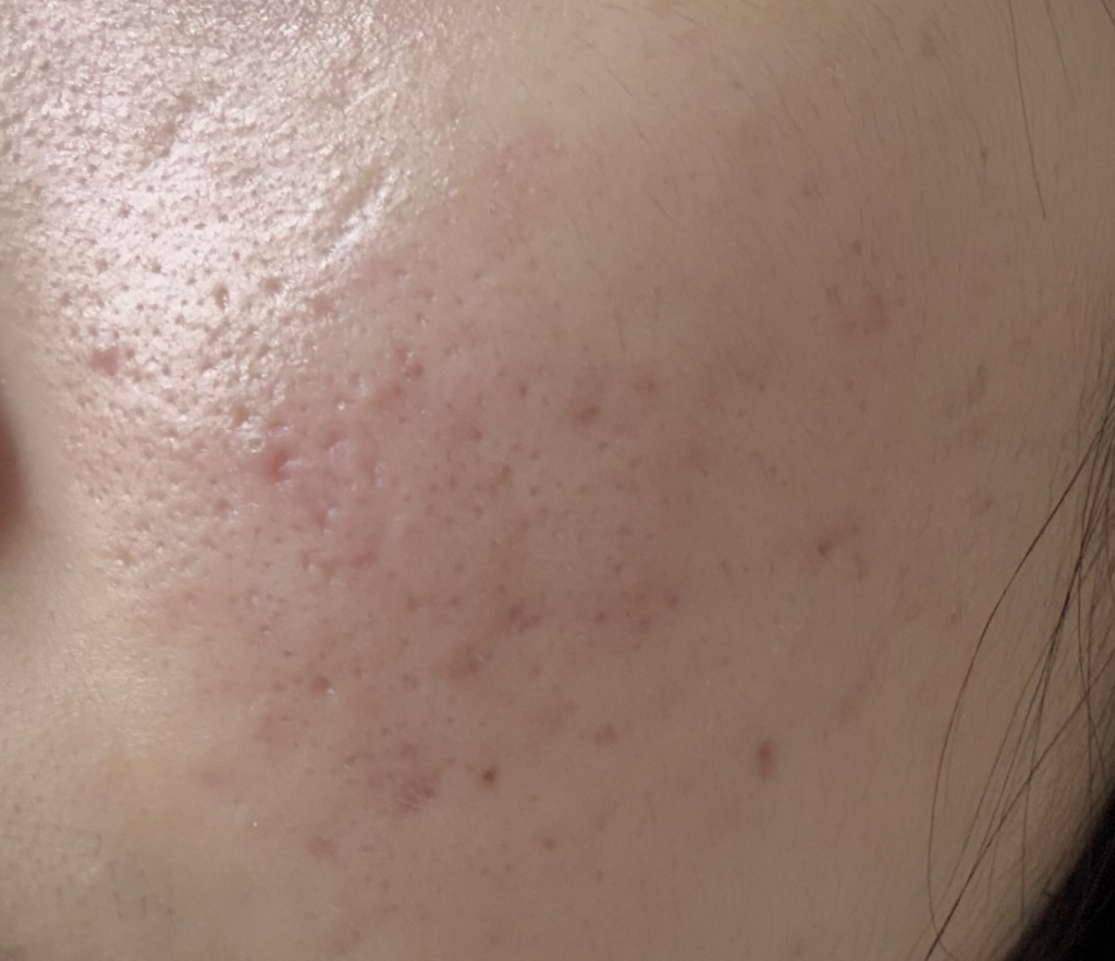 메디큐브 (medicube) PDRN 핑크 원데이 세럼 review image