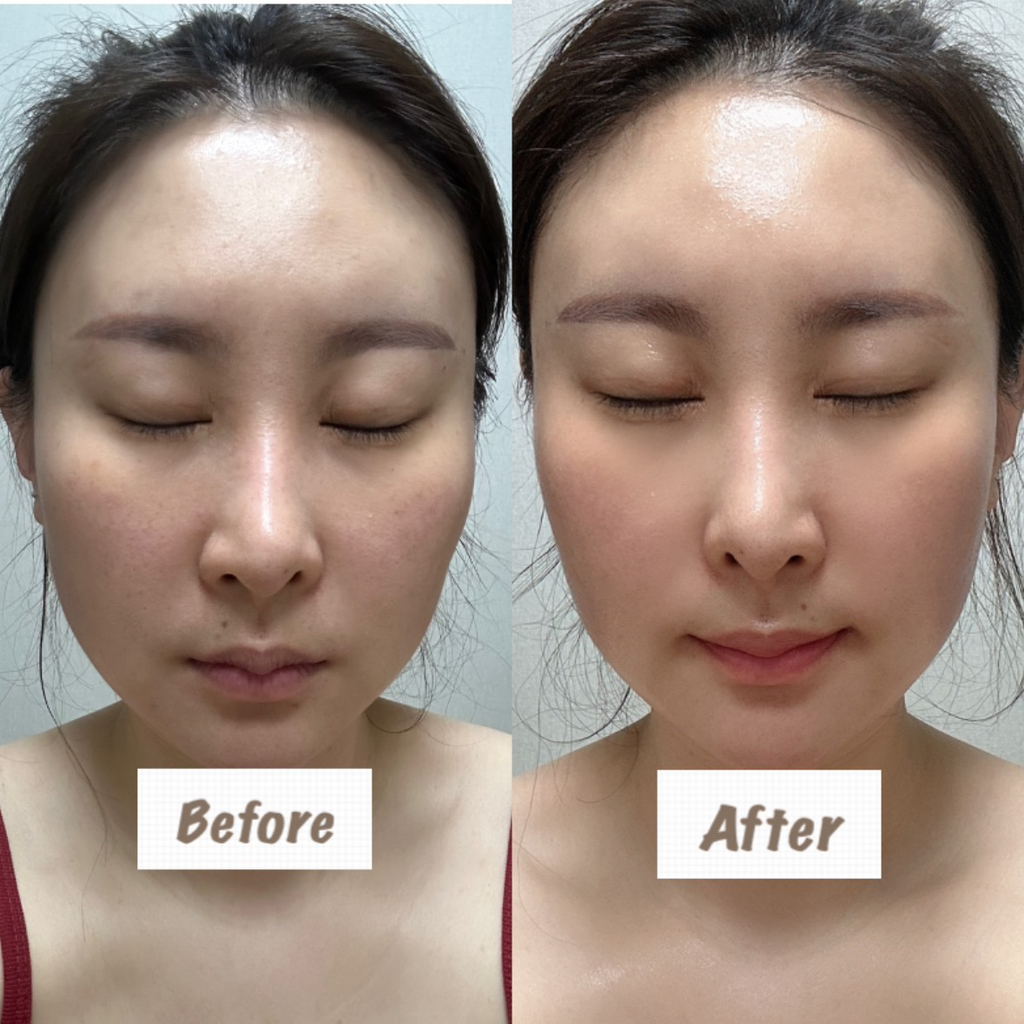 퓨리피아 (PURIPIA) 메타바이옴 보타닉 앰플 review image