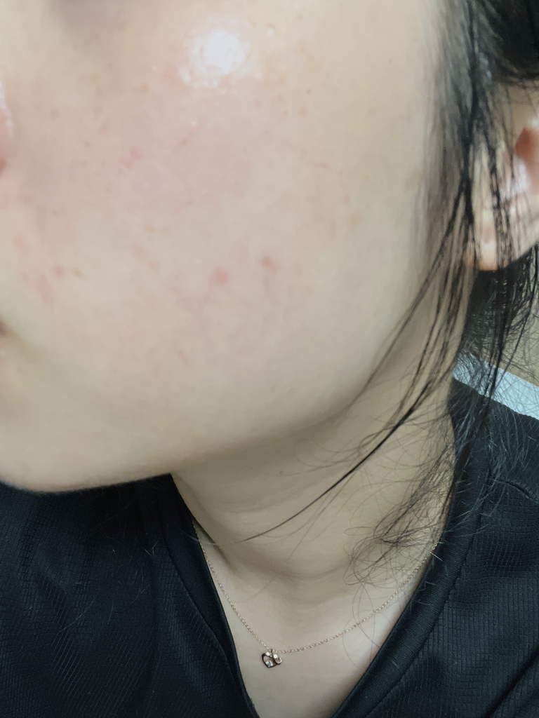 아르네 (ARNE) 라스텔로 PDRN 화이트 글로우 앰플 review image