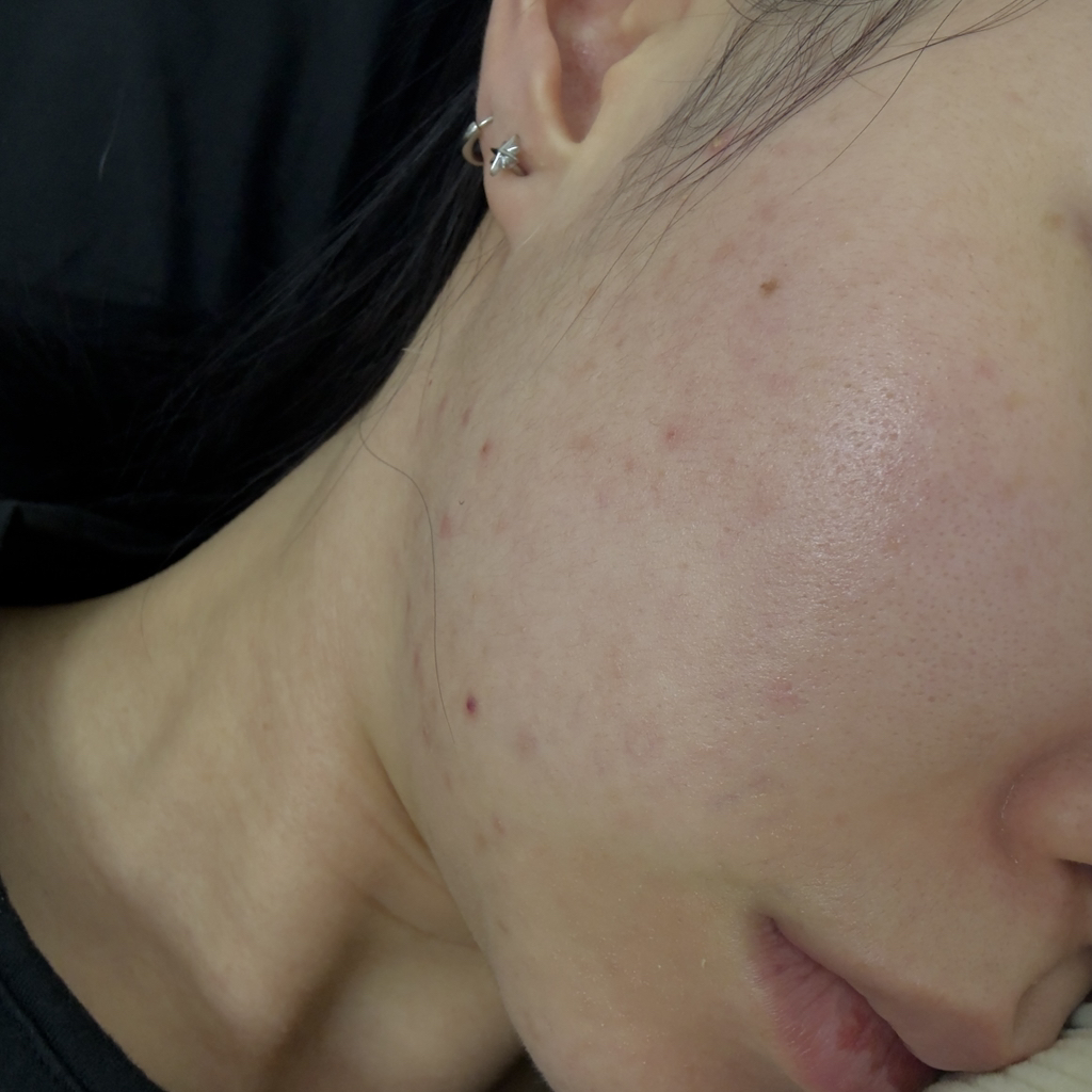 필플로 (FILFLO) 퀵 카밍 스팟 패치 review image