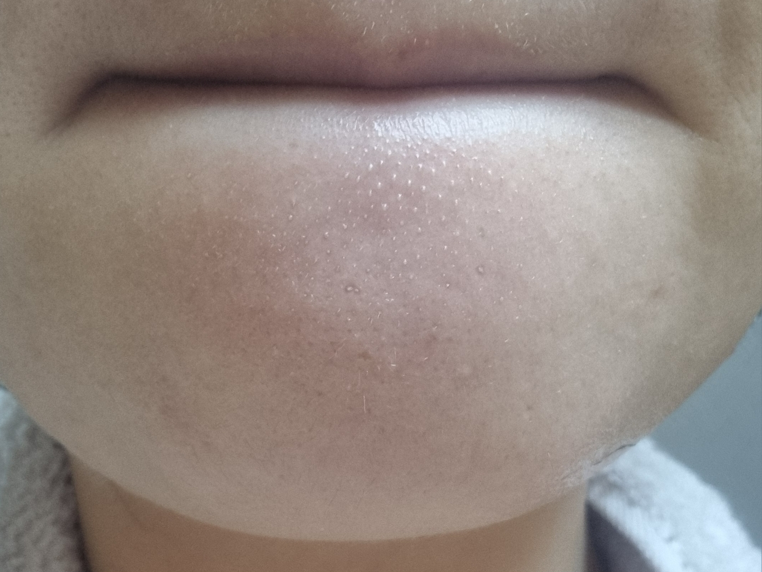 바이오힐보 (BIOHEALBOH) 세라마이드 아쿠아 토닝 필링 젤 review image