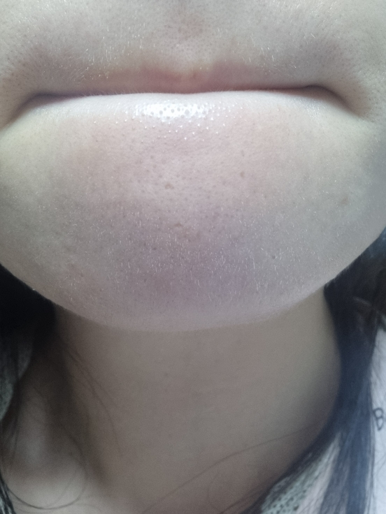 바이오힐보 (BIOHEALBOH) 세라마이드 아쿠아 토닝 필링 젤 review image