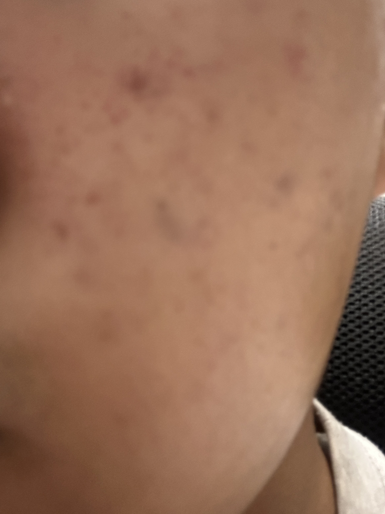 COSRX The Retinol 0.3 Cream review image