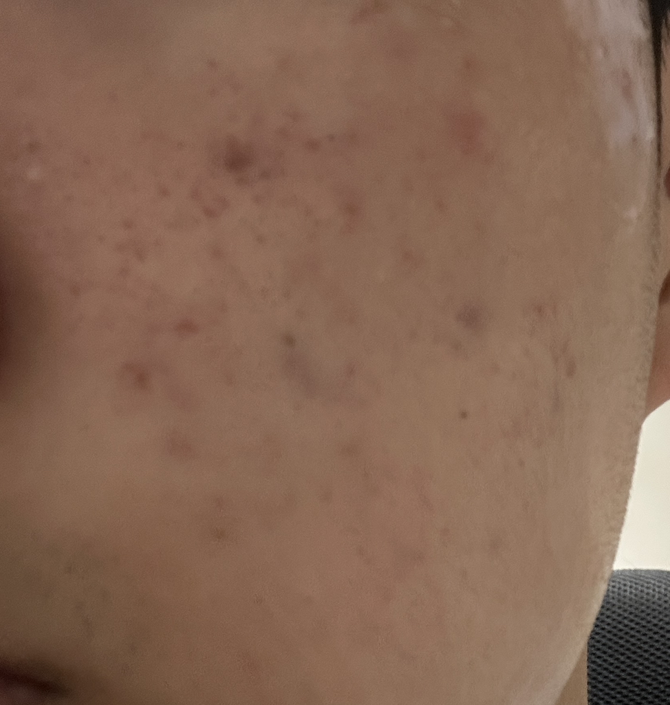 COSRX The Retinol 0.3 Cream review image
