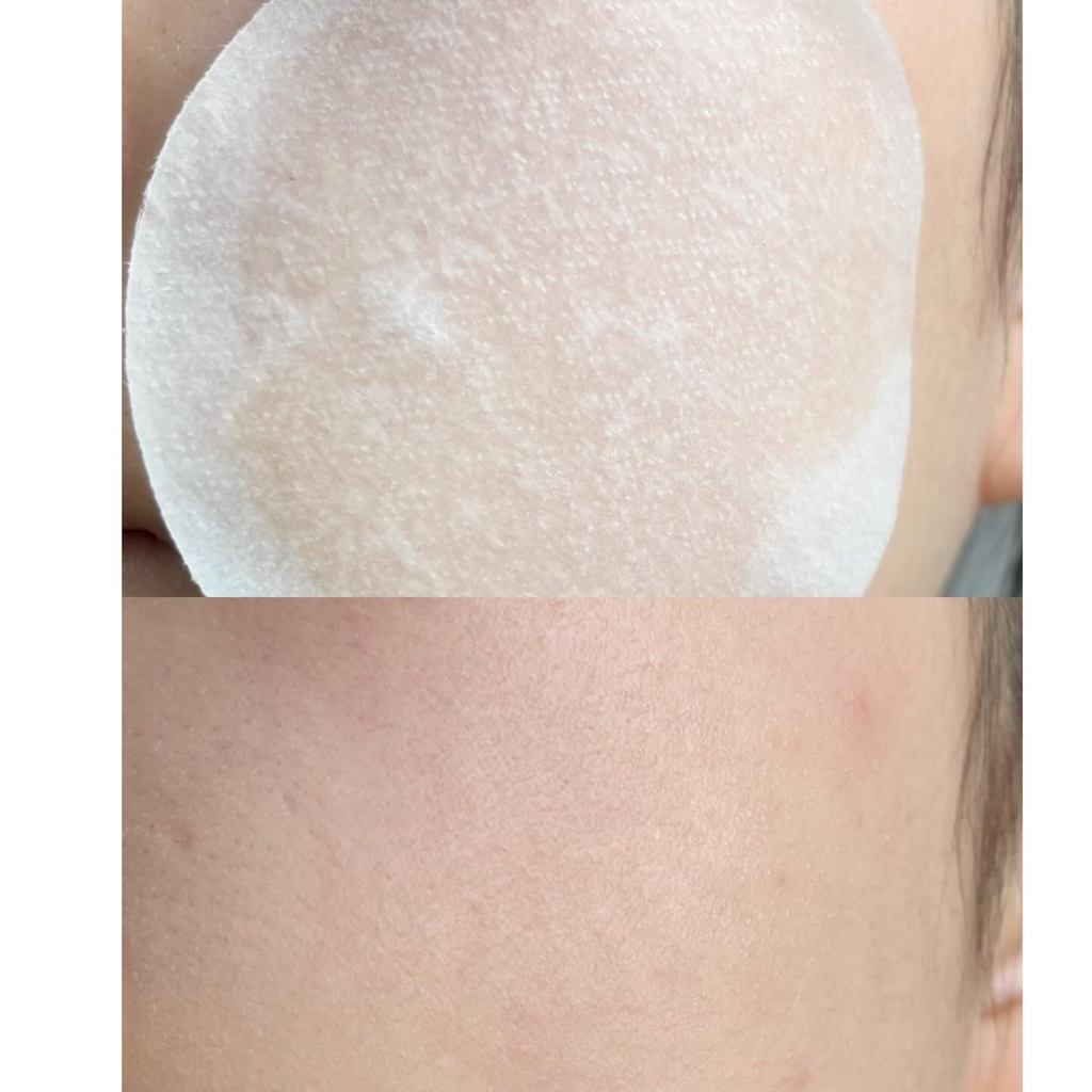 스킨푸드 (SKINFOOD) 블루 캐모마일 히알루로닉 패드 review image