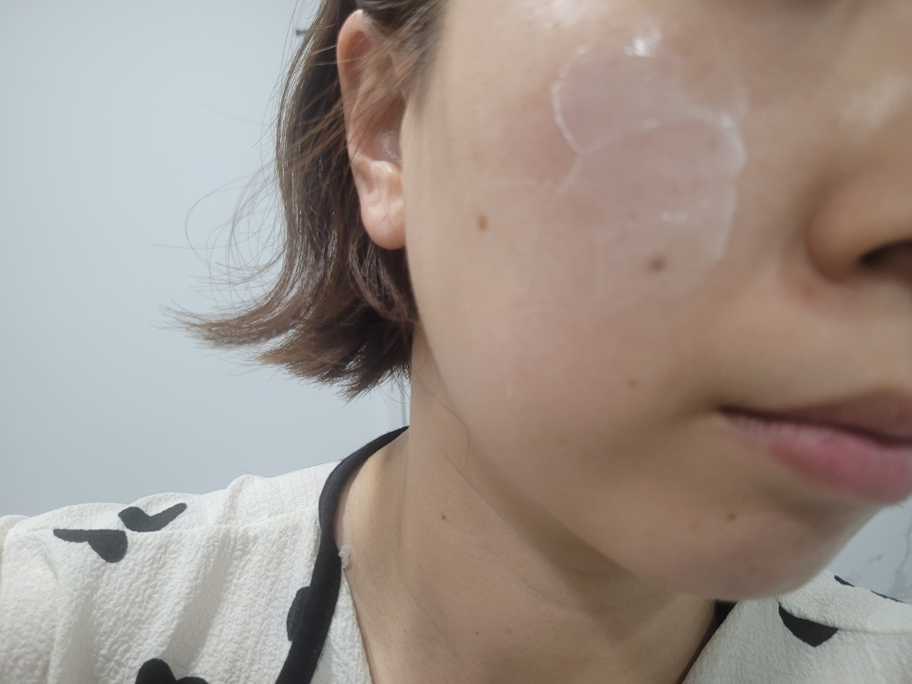 得卡解决方案舒缓霜的真实用户使用照片