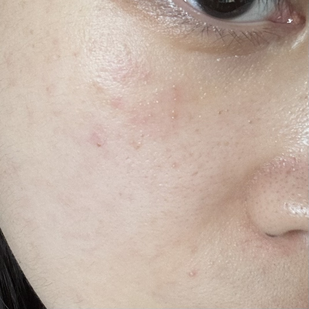 Dr.G R.E.D BLEMISH® PORE-JET Cream review image