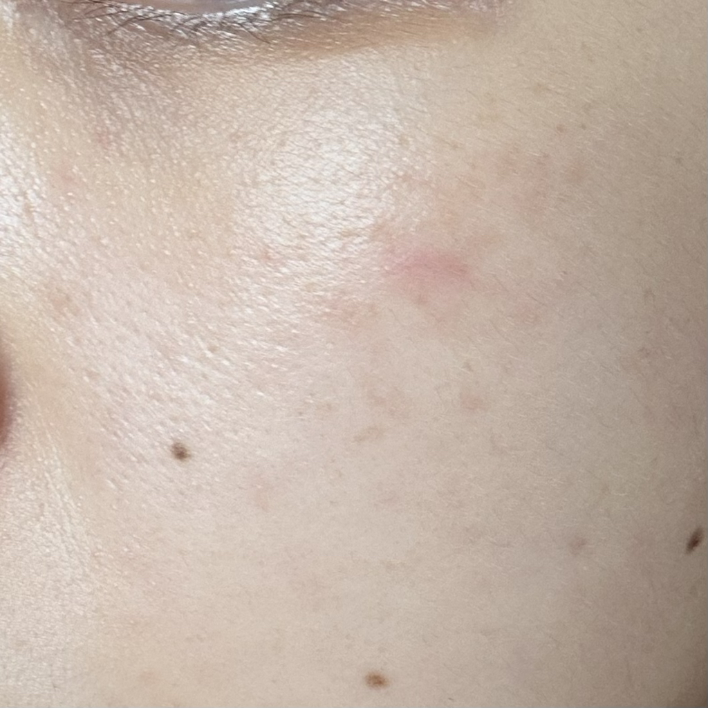 Dr.G R.E.D BLEMISH® PORE-JET Cream review image
