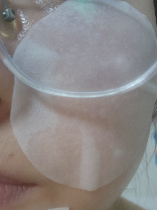 马蹄莲舒缓贴附垫的真实用户使用照片