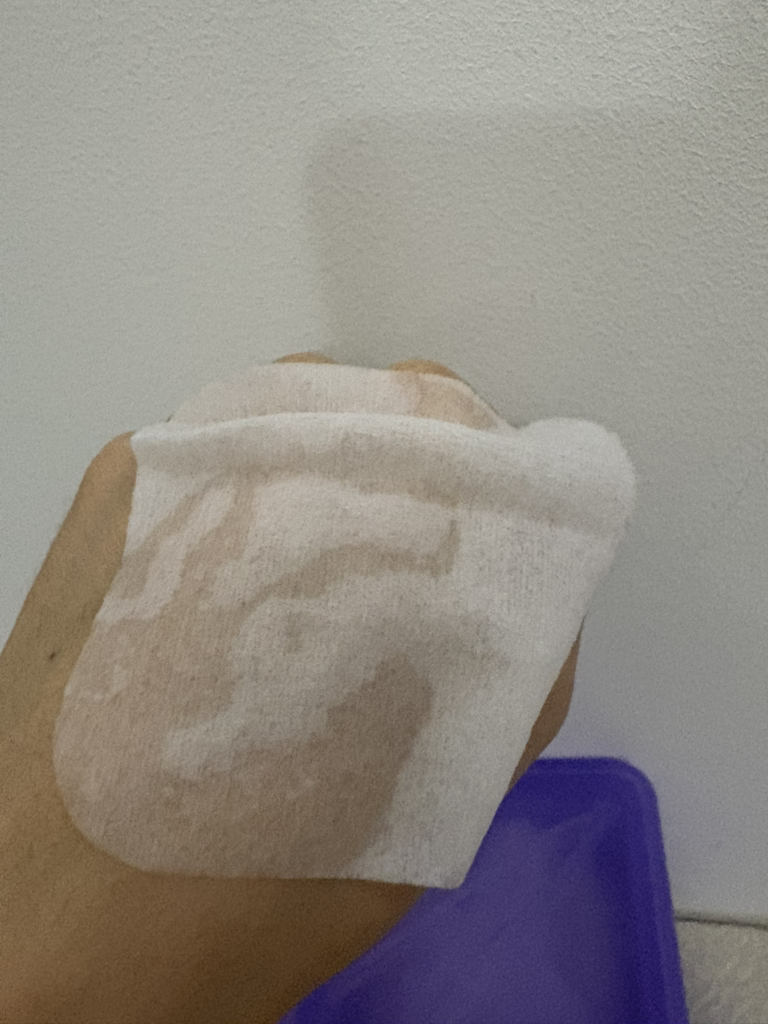 Real user review photo of PDRN LIFTING PAD