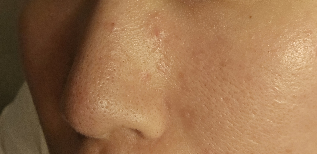 组件编辑器 绿番茄毛孔净化水洗面膜 common.review image