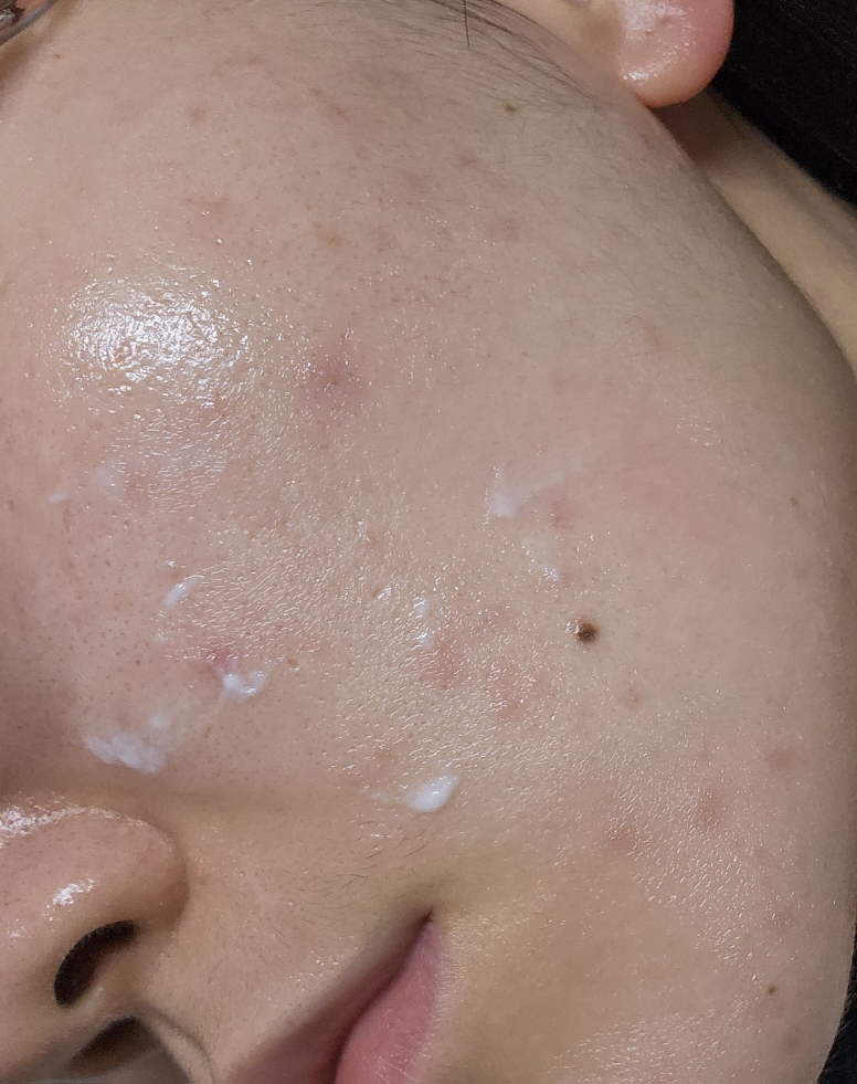 杰西诺博士强力凝胶 X6的真实用户使用照片