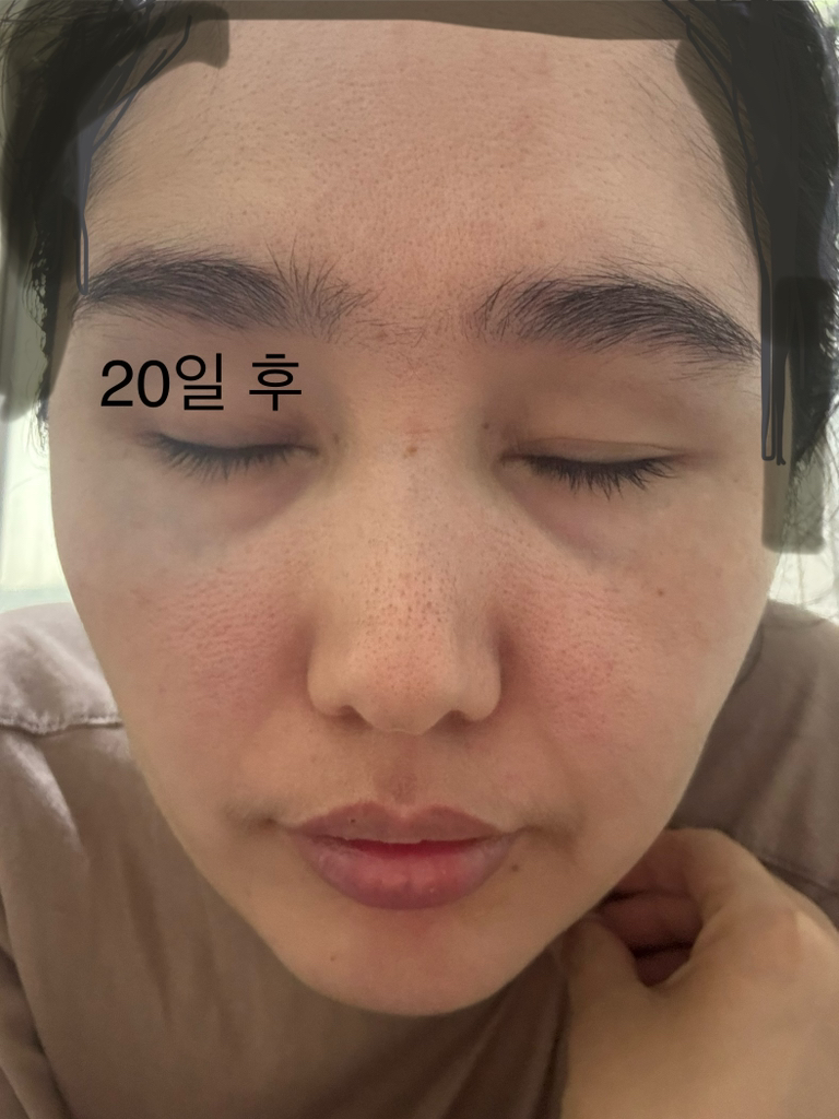 Real user review photo of PDRN Pink Peptide Serum