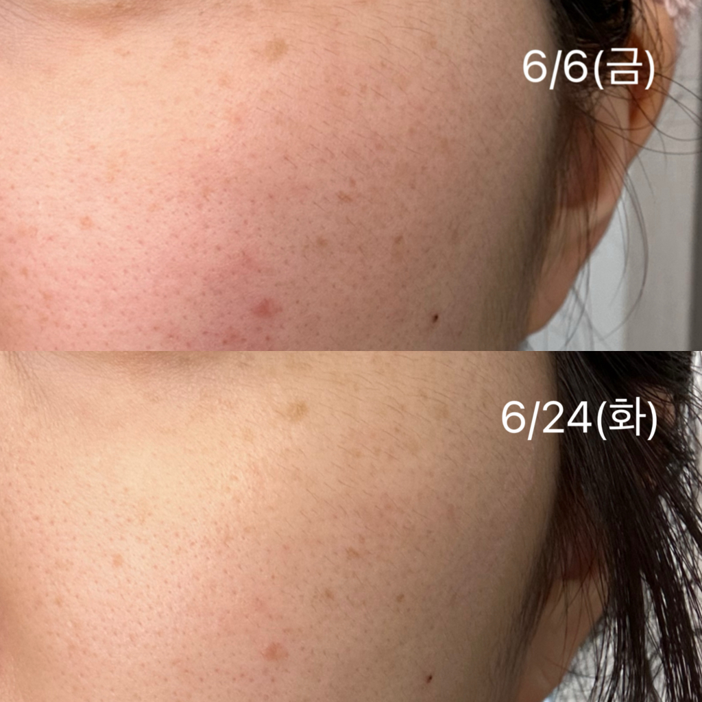 비플레인 (beplain) 레몬씨 글루타치온 미백 패드 review image