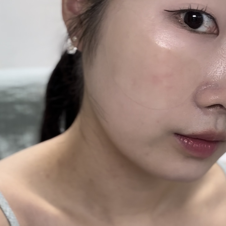파넬 (Parnell) 시카마누 클리어 패치 [멀티] review image