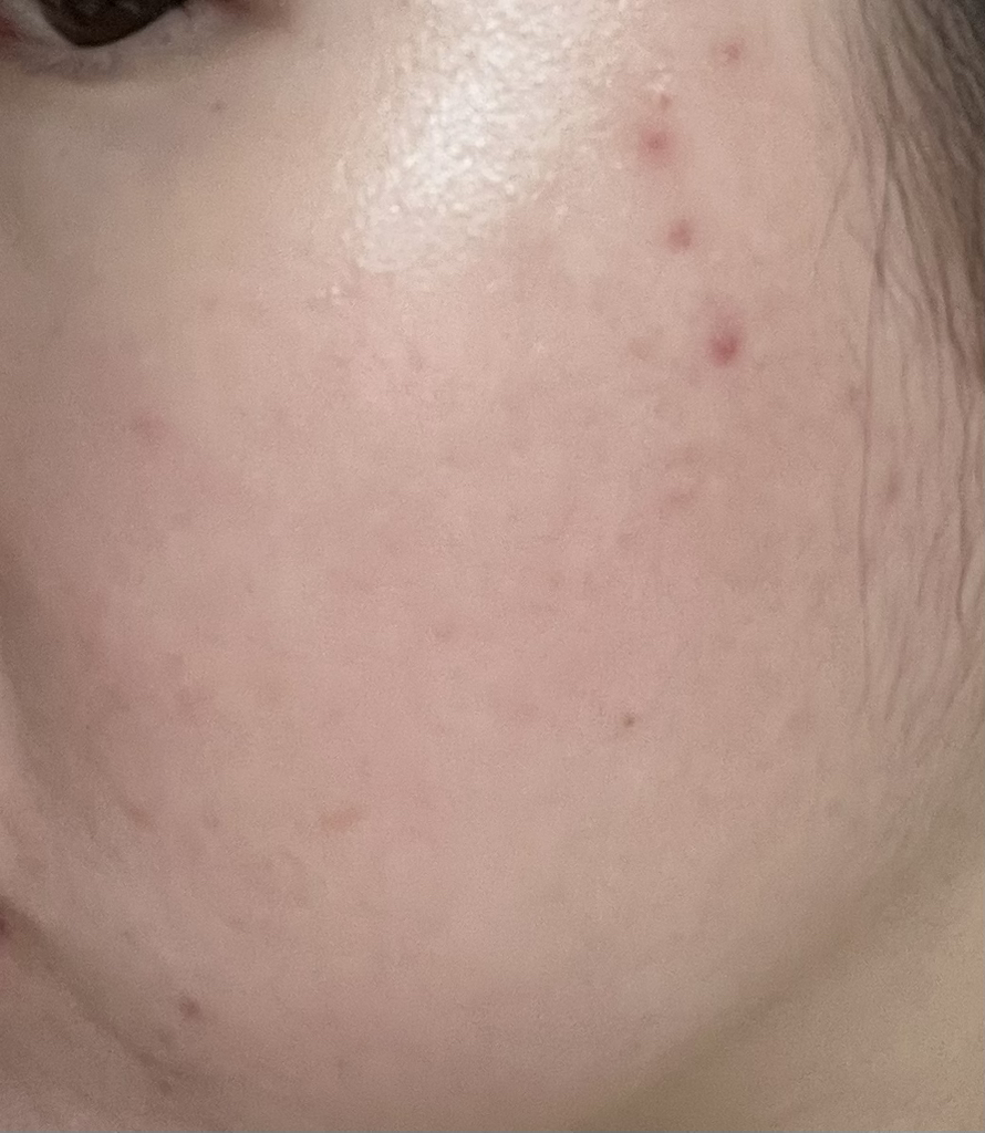 乳霜的真实用户使用照片