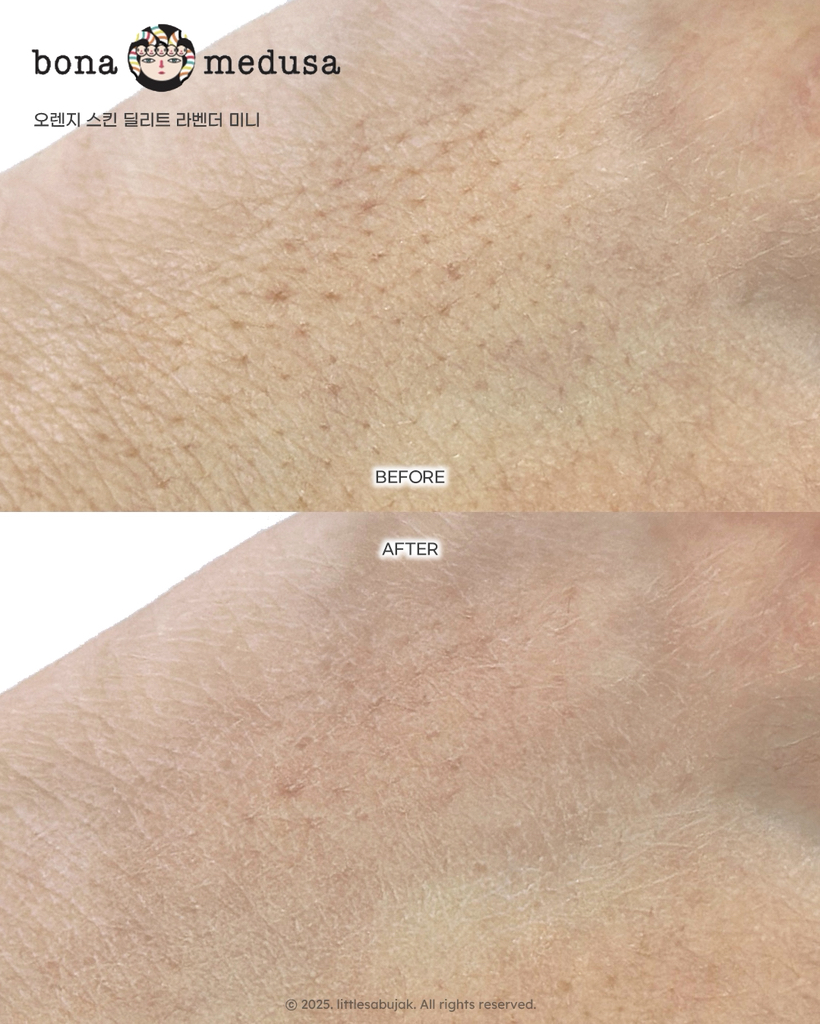 보나메두사 (bonamedusa) 오렌지 스킨 딜리트 [라벤더] review image