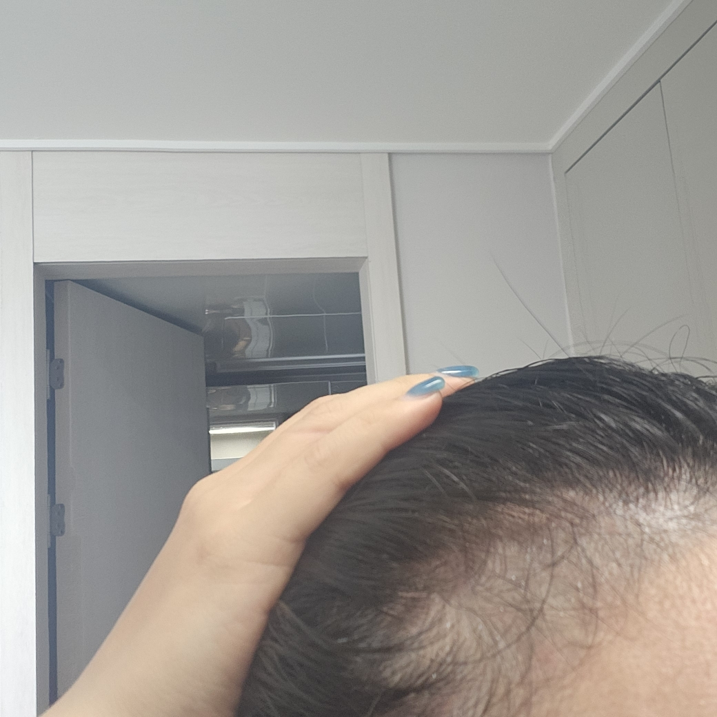 닥터포헤어 (Dr.FORHAIR) 폴리젠 씨솔트 스케일러 두피스케일링 review image