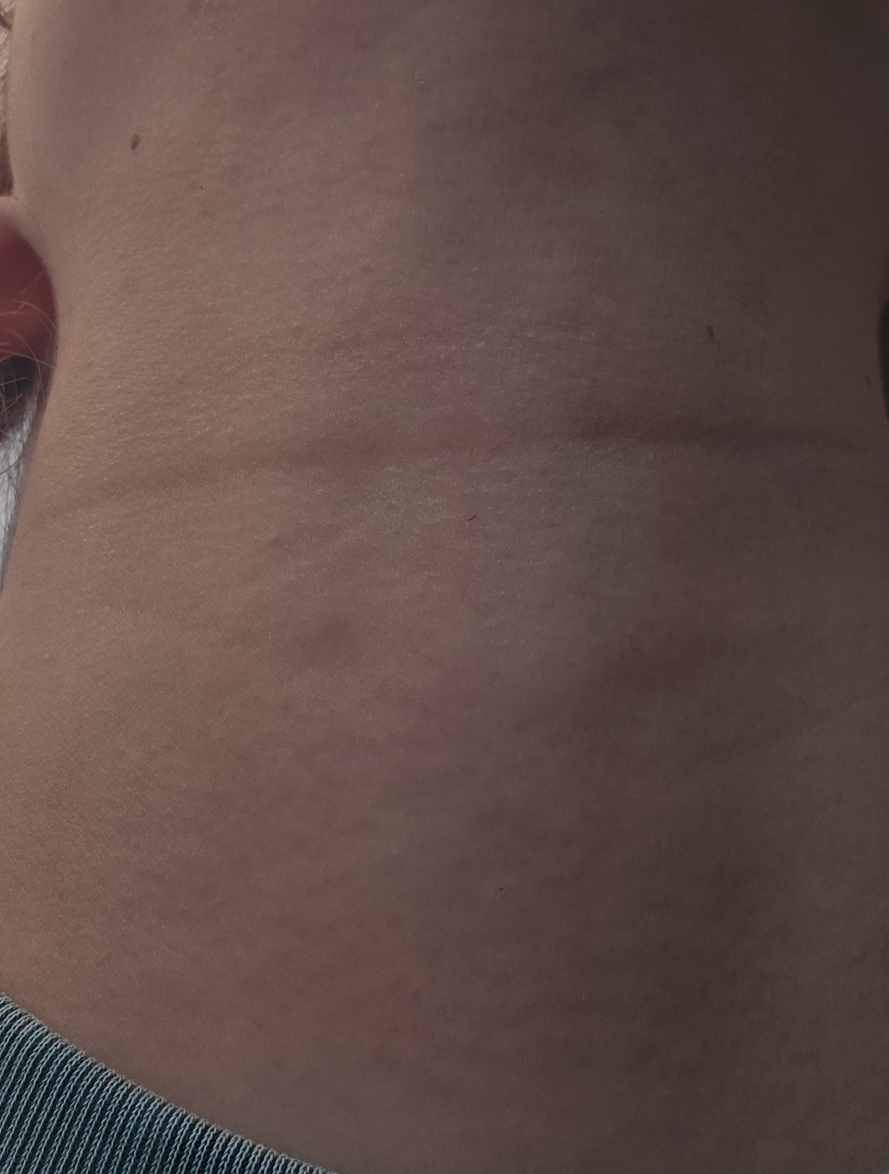 JHP코스메틱 (JHPCOSMETICS) 실크 리프팅 콜라겐 펩타이드 탄력 앰플 review image