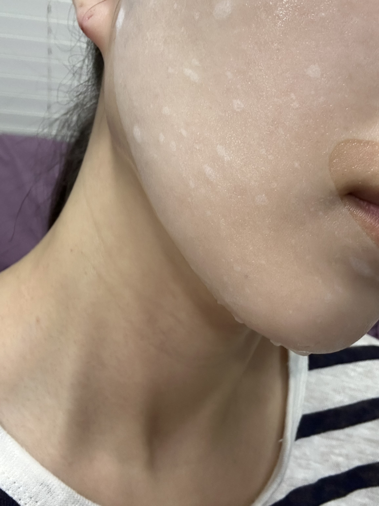 Real user review photo of Essential Mask [Rose PDRN Healthy Glow]