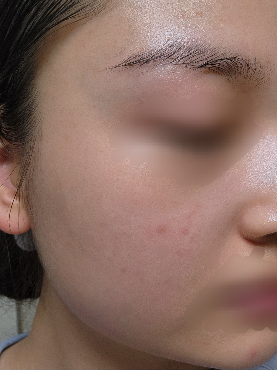 ureun Vegan AHA PHA Ampoule review image