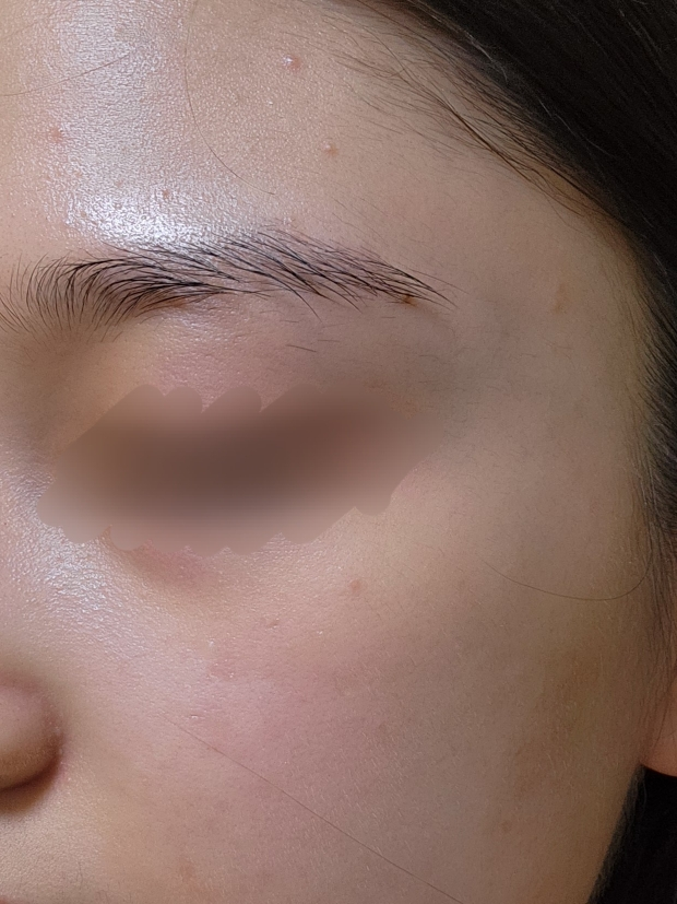 유아른 (ureun) 비건 아하파하 앰플 review image